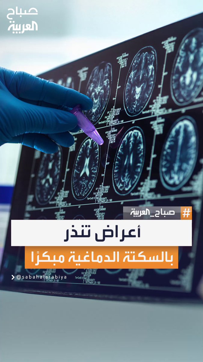 اختصاصي جراحة المخ والأعصاب محمد ملحم يحذر من علامات مبكرة قد تُنذر بالإصابة بالسكتة الدماغية…