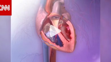 يسبب حالة من كل سبع سكتات دماغية.. كيف يساعد الاكتشاف المبكر للرجفان الأذيني في حماية قلبك؟….