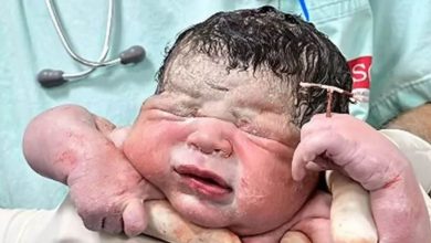 “Thousands of barking that were thunderstorms …” Copper t installed to stop the pregnancy, the child was born in hand!