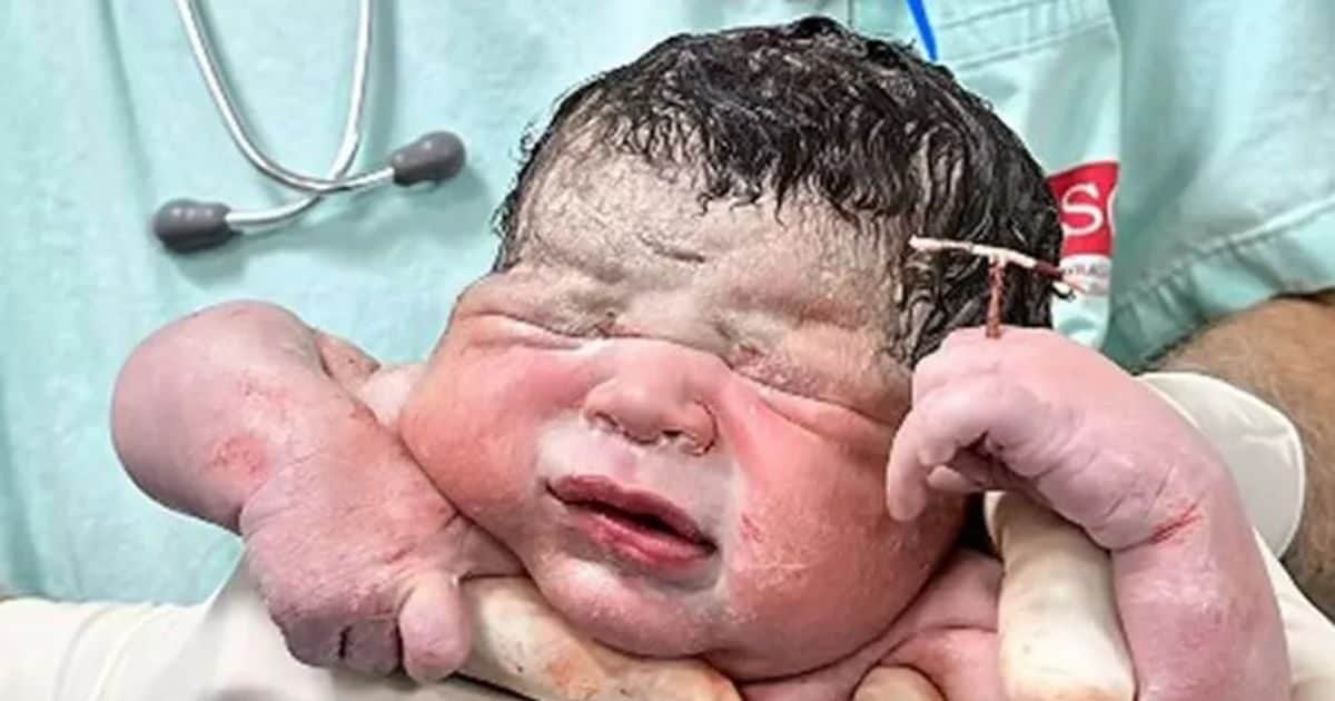 “Thousands of barking that were thunderstorms …” Copper t installed to stop the pregnancy, the child was born in hand!