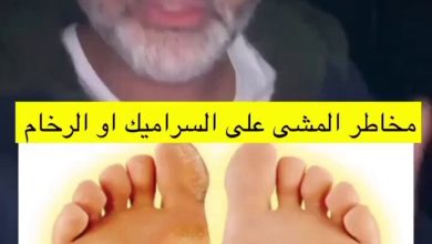 مخاطر المشي على السراميك والرخام