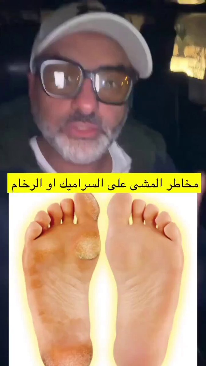 مخاطر المشي على السراميك والرخام