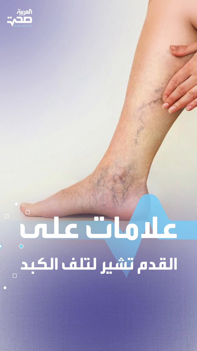 قدماك قد تكشفان عن مشاكل خطيرة في الكبد.. إليك 6 علامات تحذيرية صحة _صحة