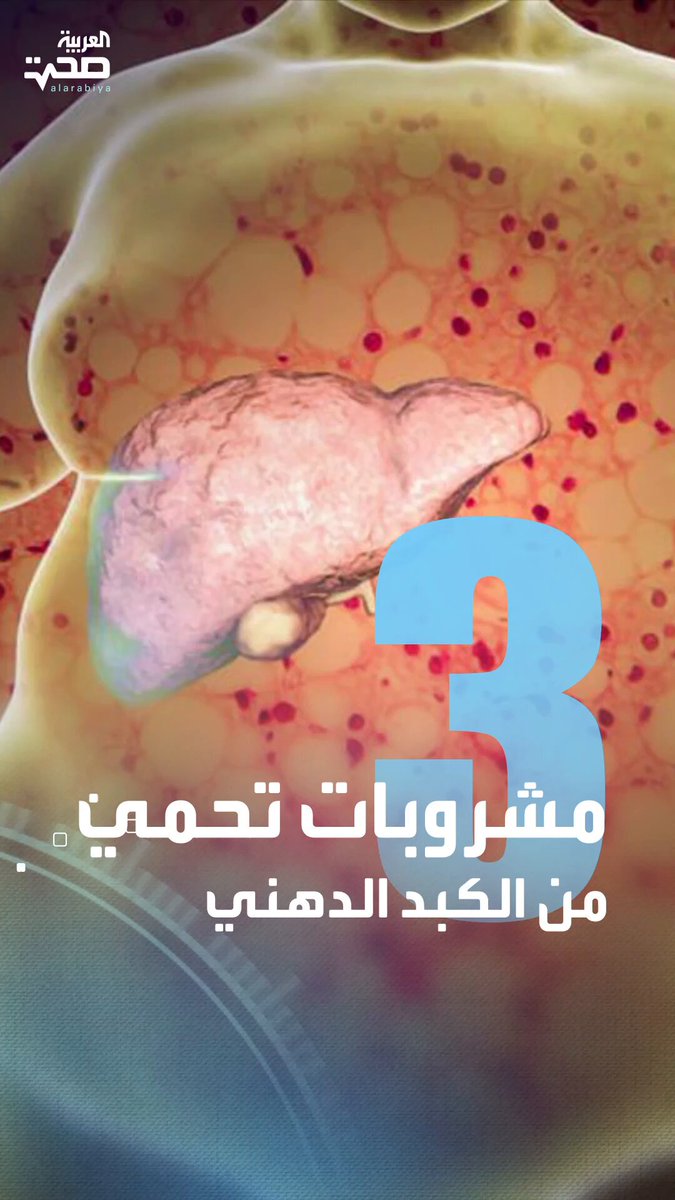 احرص عليها.. 3 مشروبات تحمي من تراكم الدهون في الكبد صحة _صحة