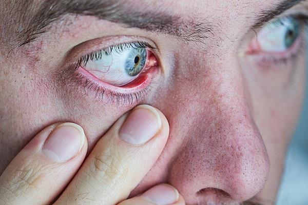 تحذيرمن أطباء العيون: الإفراط في استخدام الهواتف والتلفزيون يتسبب في “رمل العينين”