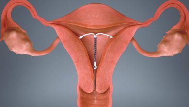 Note these components of copper T that prevent unwanted pregnancy, you can read this news before using it.