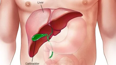 Drinks with low sugar and artificial sweeteners do not prevent fatty liver disease