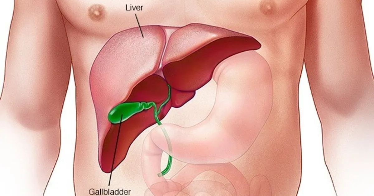 Drinks with low sugar and artificial sweeteners do not prevent fatty liver disease