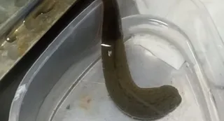 Leech Therapy: Unique treatment in plastic surgery, bloodsuckers drink the bad blood of patients, healing diseases – leech therapy in plastic surgery BRD Medical College Initiative