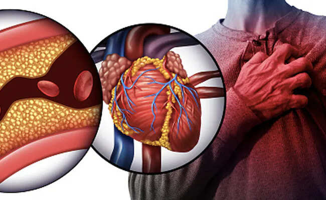 After all, why is the problem of heart attack under the youth? Know the 7 habits that act as silent murderers for your heart.