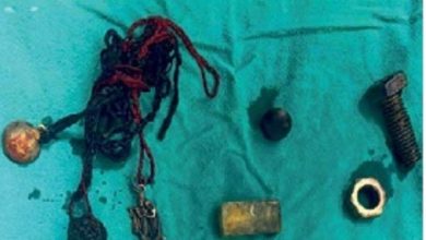 A watch and pieces of iron were removed from the stomach of a 34-year-old youth at Jaipur SMS Hospital.