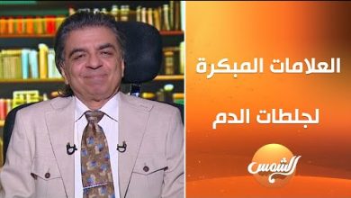 الجلطة نعمة وليست نقمة في هذه الحالة.. عميد معهد القلب السابق يوضح