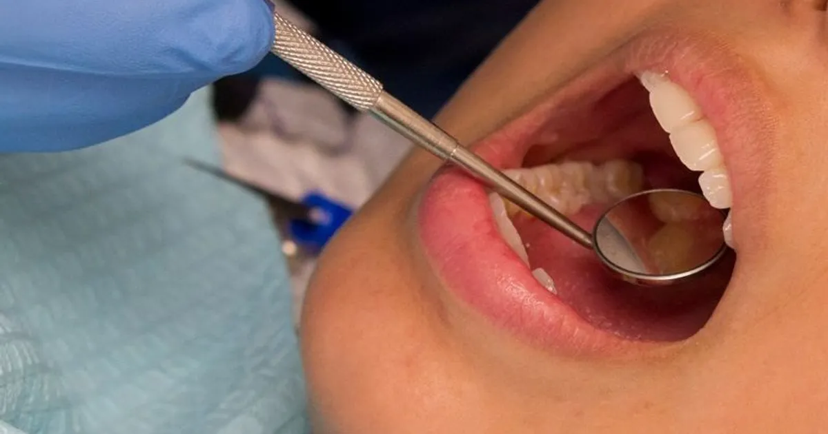Study: Drinking water can reduce the likelihood of tooth decay