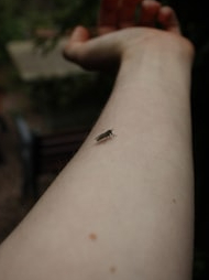 This is why bug bites itch!