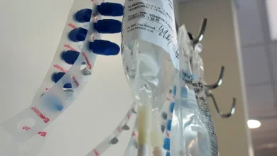 Study: A simple blood test can help determine the strength of chemotherapy