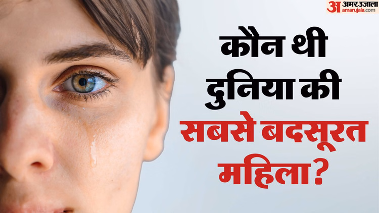 Zara Hatke:क्यों मैरी एन बीवन को मिला था दुनिया की सबसे बदसूरत महिला का खिताब? कहानी जानकर भावुक हो जाएंगे आप - Who Was The World’s Ugliest Woman? Check The Shocking True Story Duniya Ki Sabse Badsurat Mahila