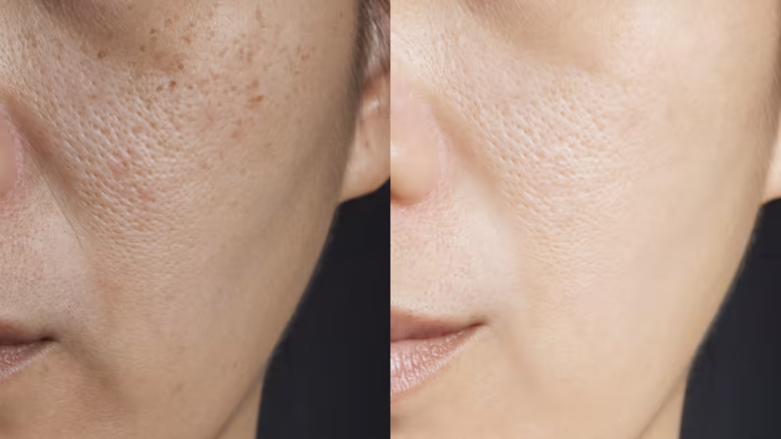 Healthy Diet For Natural Glow,बिना फेशियल चमकेगी त्वचा! अगले महीने शादी है तो रोजाना खाओ 5 चीज, चेहरे का निखार देख नजर उतारेगी सासू मां - what to eat for naturally glowing face dietitian shweta nakra shared 5 healthy foods list for bright skin - Beauty & Skin News