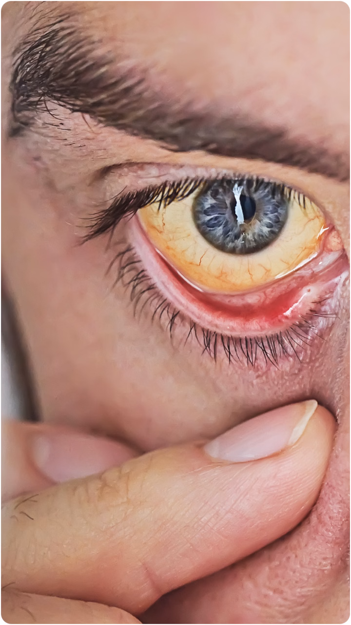 à¤¬à¤¾à¤°-à¤¬à¤¾à¤° à¤ªà¥à¤²à¤¿à¤¯à¤¾ à¤¹à¥à¤¨à¥ à¤à¥ à¤à¥à¤¯à¤¾ à¤µà¤à¤¹ à¤¹à¥?