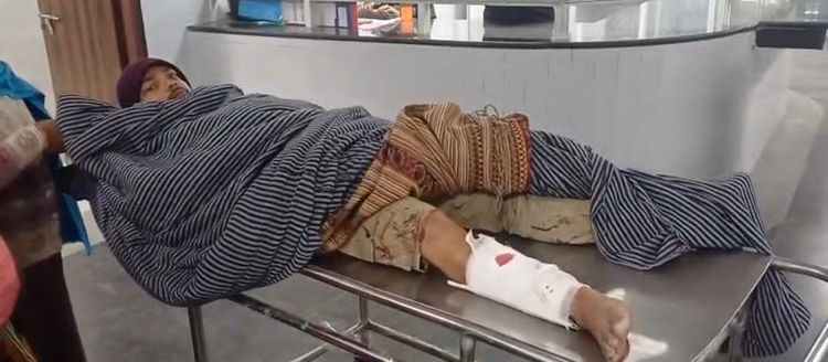 Road Rage Over Speed Breaker: Armed Assault Leaves Youth With Broken Hand And Leg In Munger - Bihar News