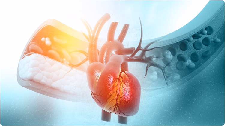 Health Tips:कोलेस्ट्रॉल बढ़ने के ये होते हैं शुरुआती लक्षण, डॉक्टर से जानें क्या है इसके पीछे का मूल कारण - Health Tips: Cholesterol Rising Root Cause Know From Doctor In Hindi