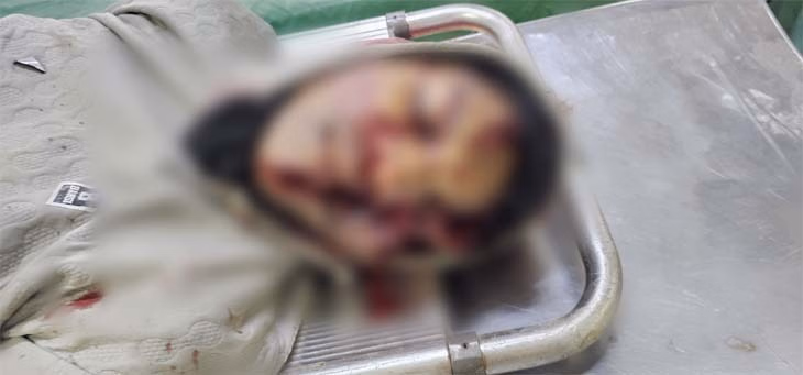 Four Peopleincluding An Innocent Child, Died In A Road Accident In Raigarh - Raigarh News - रायगढ़ :अलग-अलग सड़क हादसों में चार लोगों की मौत, एक नाबालिग भी शामिल, वाहन चालक के खिलाफ मुकदमा