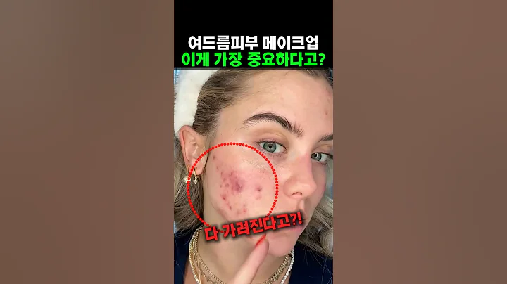 여드름 메이크업 장인이 알려주는 꿀팁 #makeup  #메이크업 #해외댓글반응 #여드름 #여드름화장