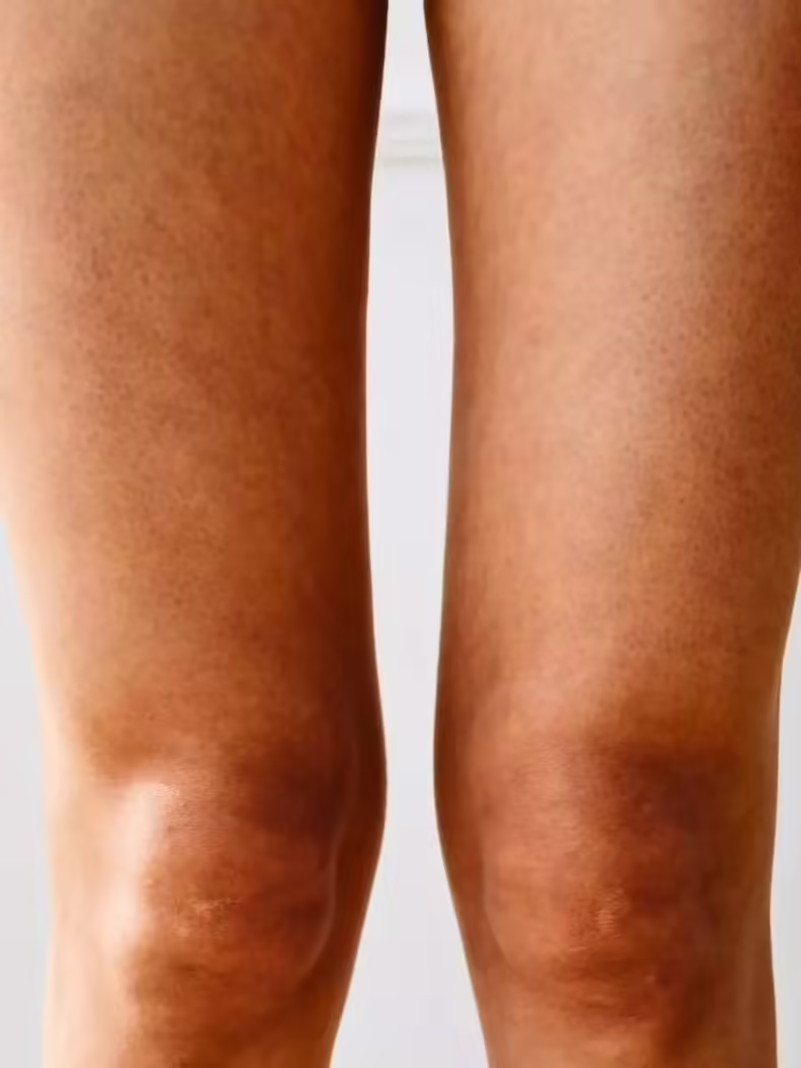 घुटनों को ठंड से बचाना क्यों है जरूरी? | Navbharat Times