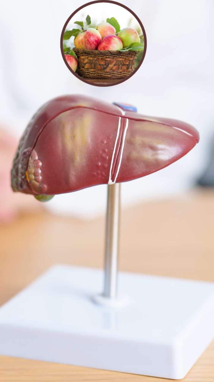 Fatty liver is no less than any nectar, these fruits will be many benefits by eating