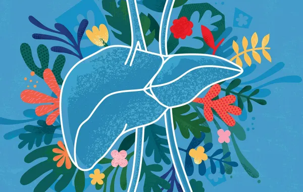 دهون الكبد (الكبد الدهني) هي تراكم الدهون بنسبة تزيد عن 5% داخل خلايا الكبد، وهي شائعة ويمكن…