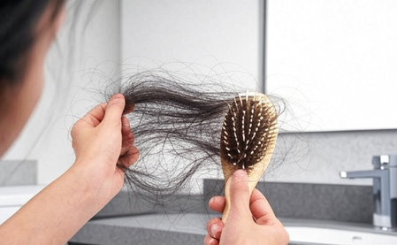 Is your hair falling out because of these mistakes? Know the right methods of Ayurveda